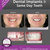 The Dental Implant Group image 2
